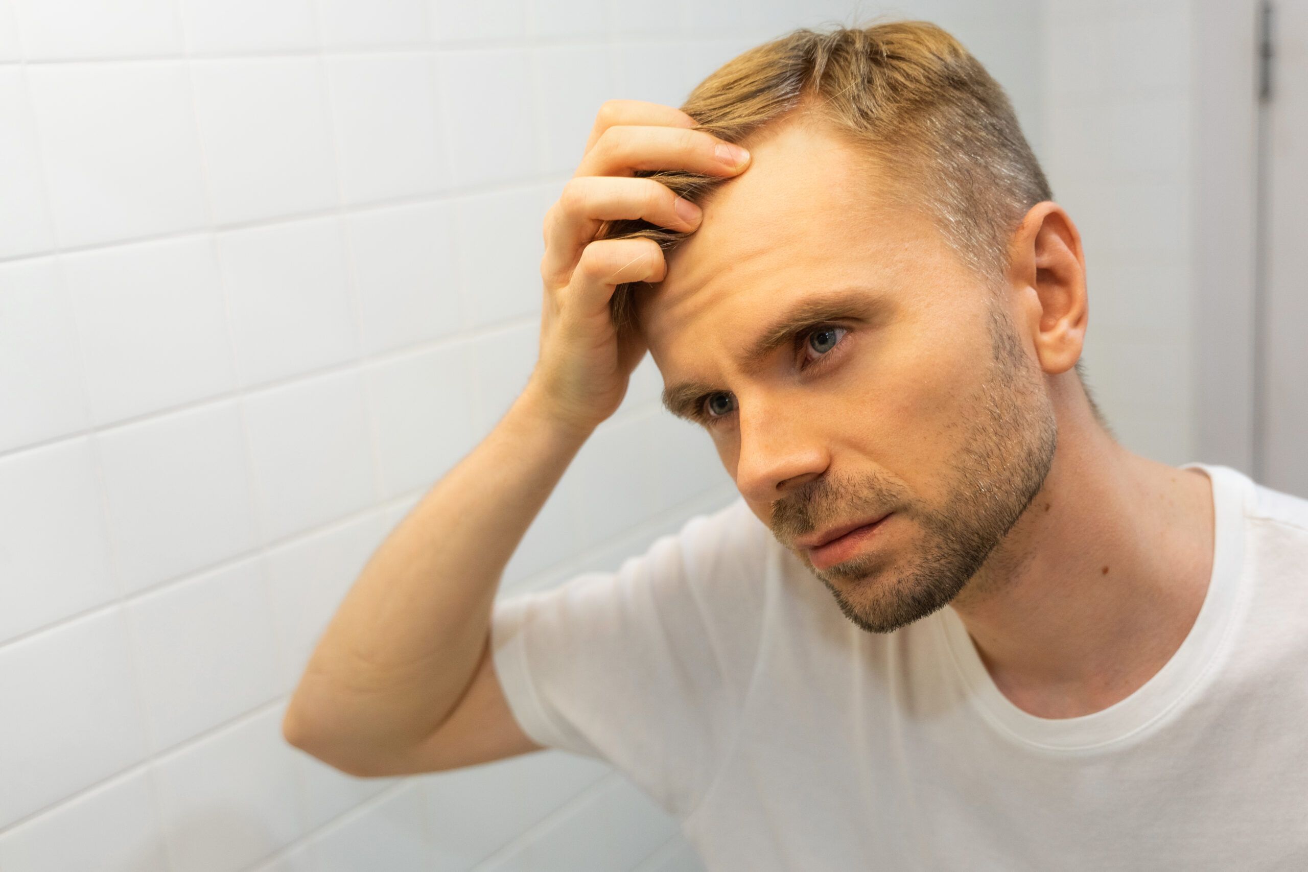 Hombre joven con alopecia androgénica observando la caída del cabello, tratamiento capilar en Valencia sin cirugía